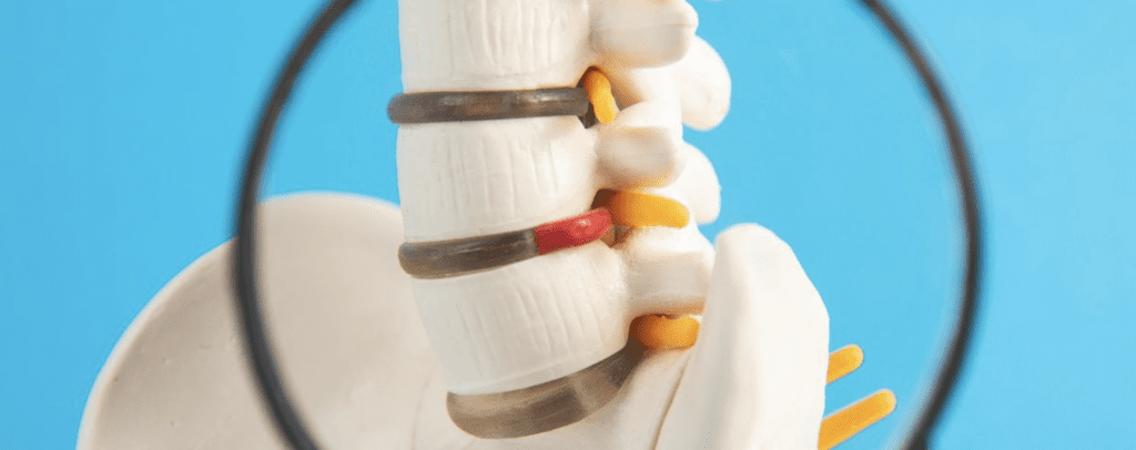 pinched-nerve-vs-pulled-muscle - Innovative Health Care Centers
