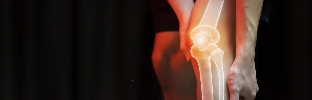 knee-pain-going-down-stairs-one - Innovative Health Care Centers