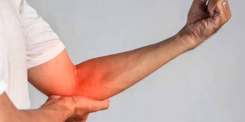 Forearm with a large red, irritated patch near the elbow area.